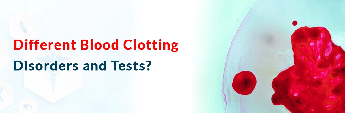  Different Blood Clotting Disorders and Tests?